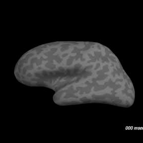 Kombinert bruk av MEG og MRI Respons når en ser