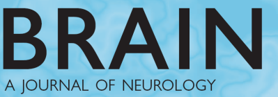 Energimangel Hjernen epilepsi; enefalopati (dårlig fungerende hjerne); ataksi (ustøhet) mm Muskel økt trettbarhet; smerter (også melkesyre); kraftsvekkelse Øye affeksjon av øyebunn; dobbelsyn