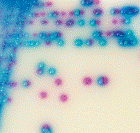 Prøvemateriale (eswab fra anus) dyrkes på CHROMAgar VRE Etter 1-2 døgn: VRE-screening ved vår lab E.