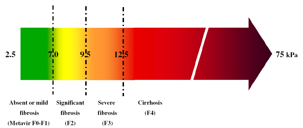 (Fibroscan )