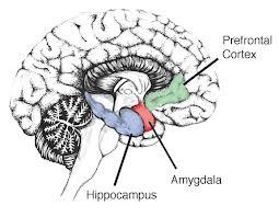 Hjernen danner en skjærende disharmoni Dysregulering av hjernefunksjoner Auditory cortex onstant og intenst lyd Nedsatt