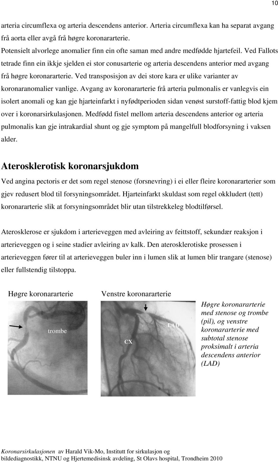 Ved Fallots tetrade finn ein ikkje sjelden ei stor conusarterie og arteria descendens anterior med avgang frå høgre koronararterie.