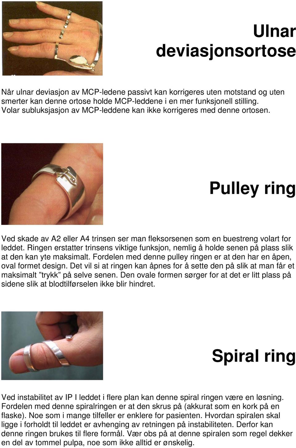 Ringen erstatter trinsens viktige funksjon, nemlig å holde senen på plass slik at den kan yte maksimalt. Fordelen med denne pulley ringen er at den har en åpen, oval formet design.