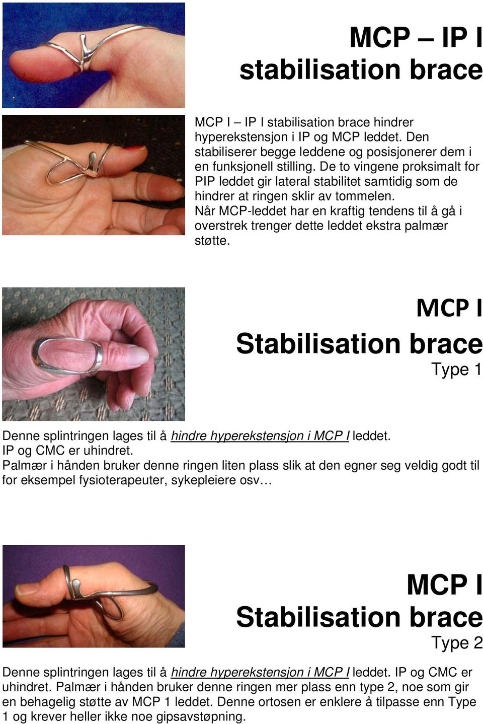 Når MCP-leddet har en kraftig tendens til å gå i overstrek trenger dette leddet ekstra palmær støtte.