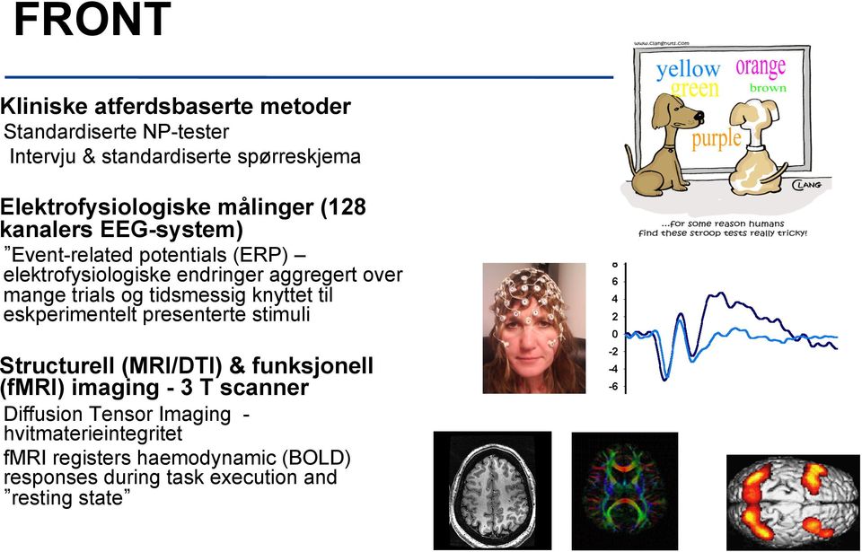 og tidsmessig knyttet til eskperimentelt presenterte stimuli Structurell (MRI/DTI) & funksjonell (fmri) imaging - 3 T scanner