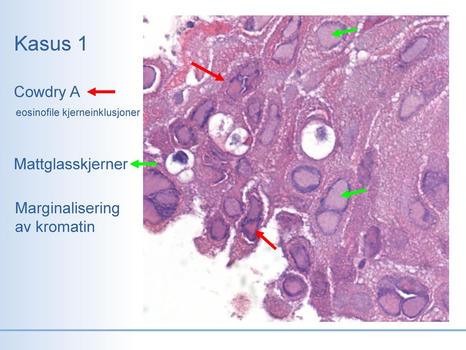 kjerneinklusjoner