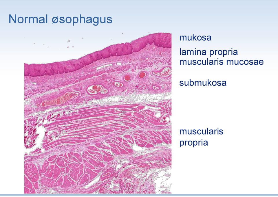 muscularis mucosae