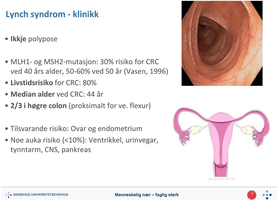 ved CRC: 44 år 2/3 i høgre colon (proksimalt for ve.