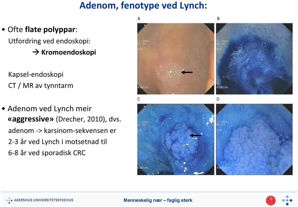 Adenom ved Lynch meir «aggressive» (Drecher, 2010), dvs.