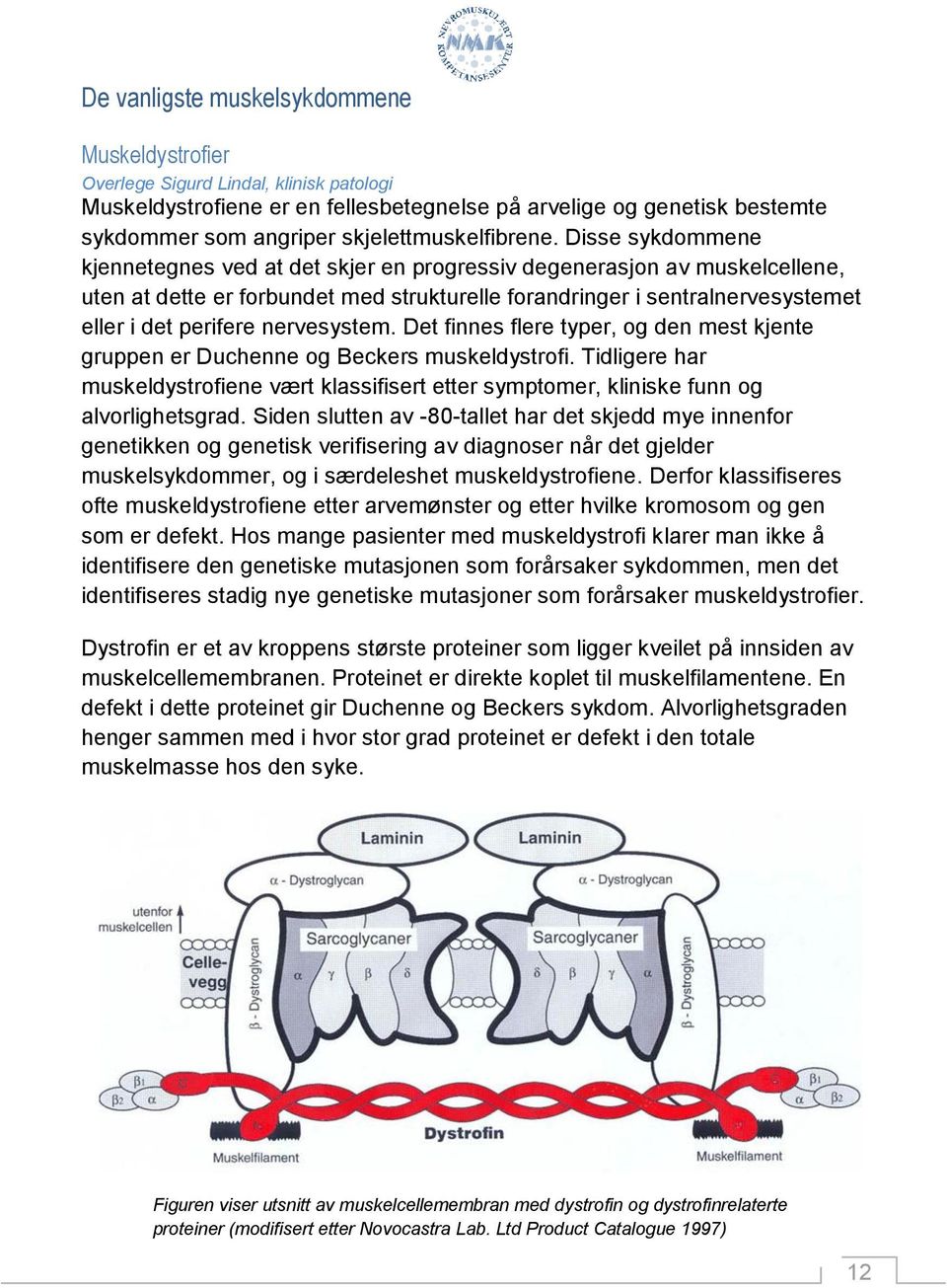 Disse sykdommene kjennetegnes ved at det skjer en progressiv degenerasjon av muskelcellene, uten at dette er forbundet med strukturelle forandringer i sentralnervesystemet eller i det perifere