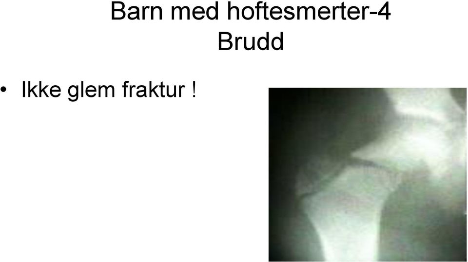 Barn med