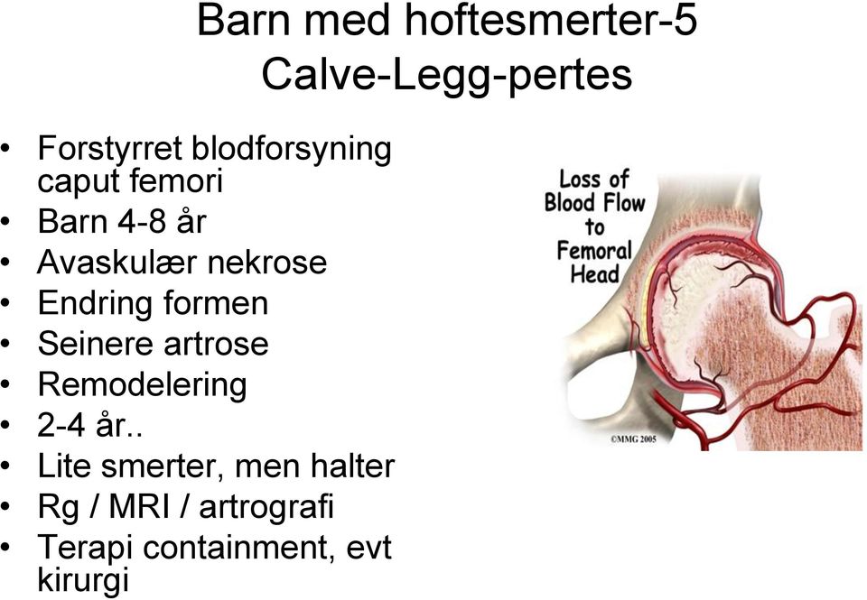 Endring formen Seinere artrose Remodelering 2-4 år.