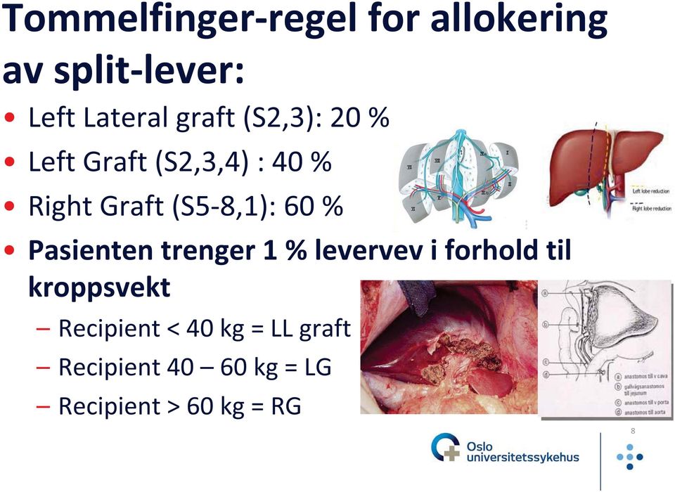 60 % Pasienten trenger 1 % levervev i forhold til kroppsvekt