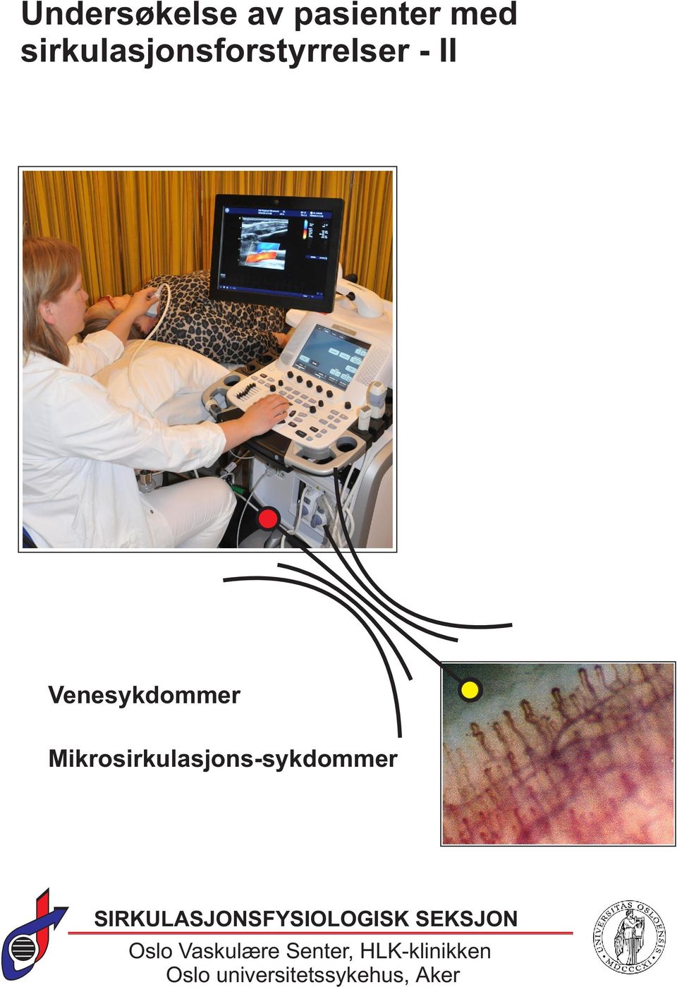 Mikrosirkulasjons-sykdommer