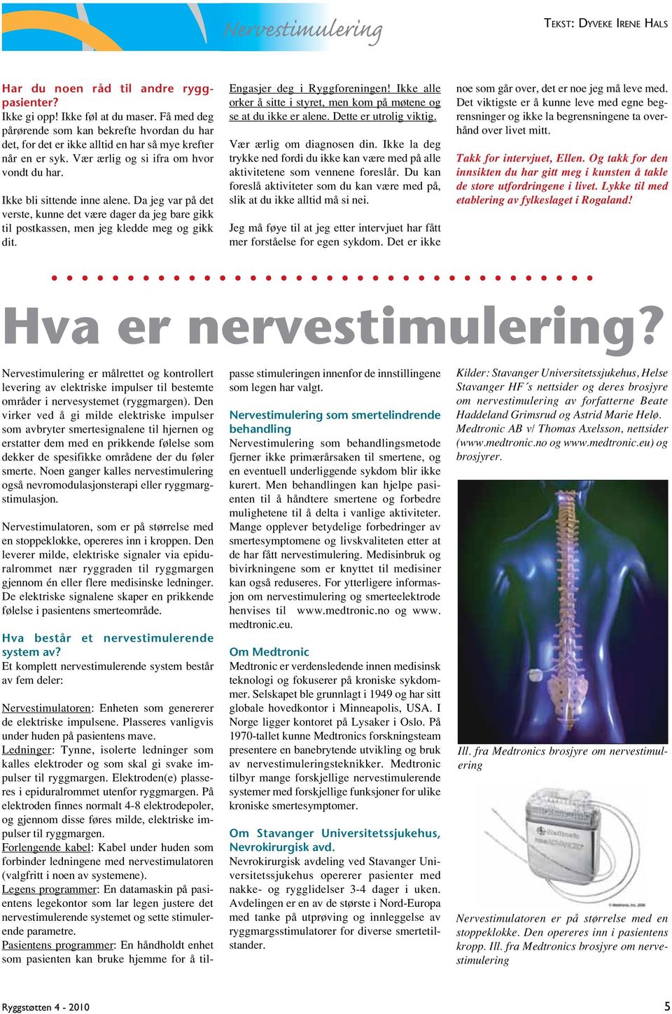 Da jeg var på det verste, kunne det være dager da jeg bare gikk til postkassen, men jeg kledde meg og gikk dit. Engasjer deg i Ryggforeningen!