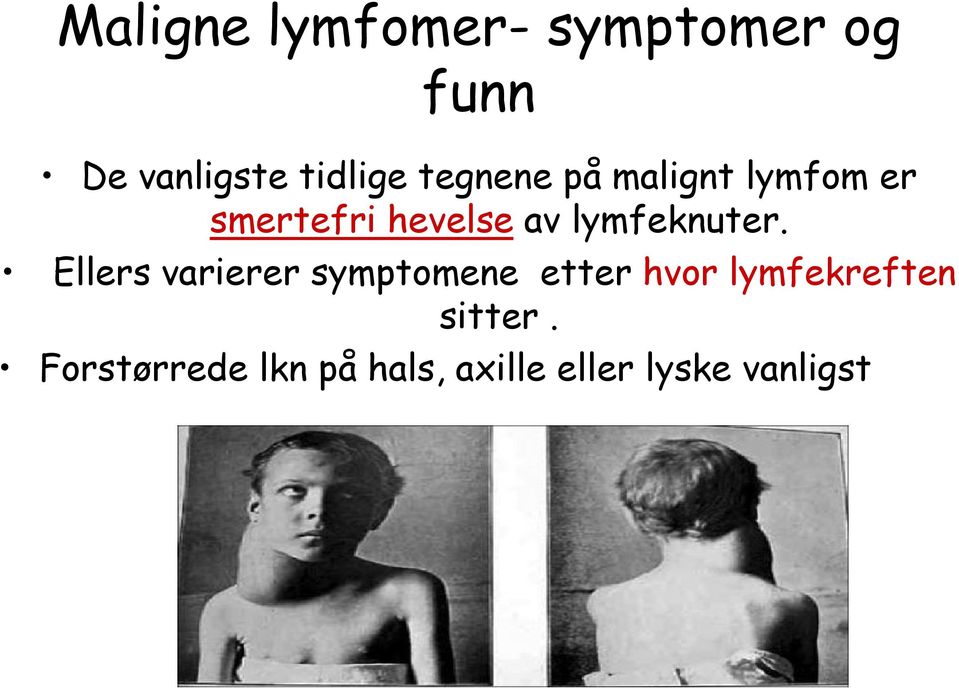 lymfeknuter.