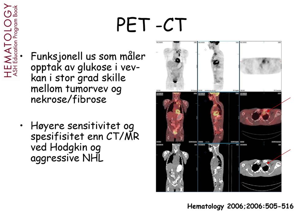 nekrose/fibrose Høyere sensitivitet og spesifisitet