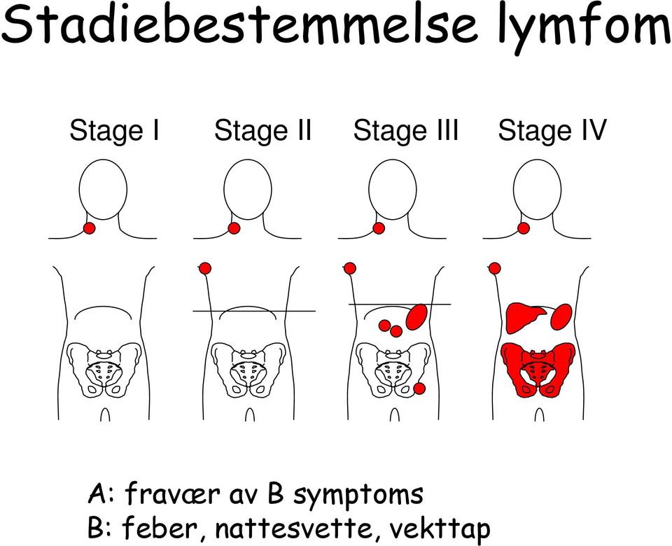 Stage IV A: fravær av B