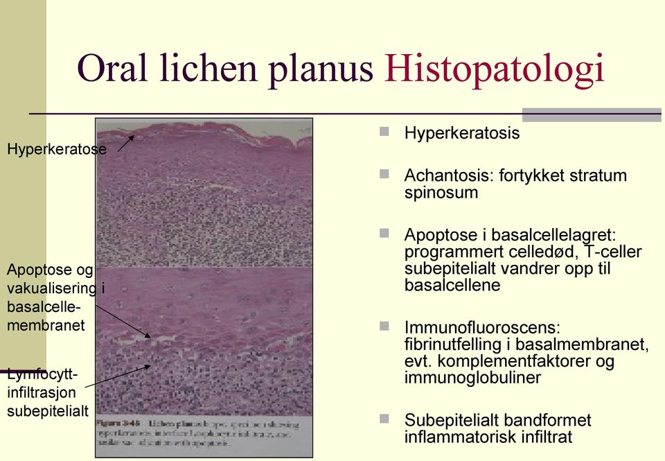 subepitelialt programmert celledød, T-celler subepitelialt vandrer opp til basalcellene Immunofluoroscens: