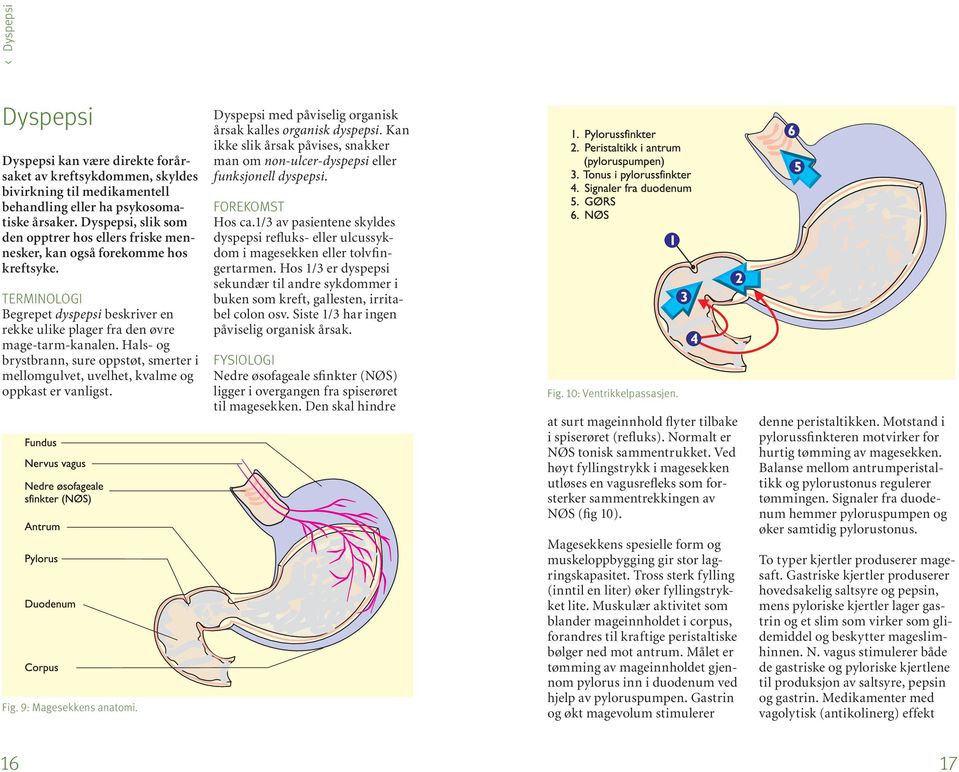 Hals- og brystbrann, sure oppstøt, smerter i mellomgulvet, uvelhet, kvalme og oppkast er vanligst. Fig. 9: Magesekkens anatomi. Dyspepsi med påviselig organisk årsak kalles organisk dyspepsi.