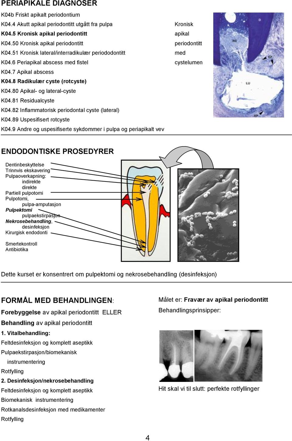 8 Radikulær cyste (rotcyste) K04.80 Apikal- og lateral-cyste K04.81 Residualcyste K04.82 Inflammatorisk periodontal cyste (lateral) K04.89 Uspesifisert rotcyste K04.