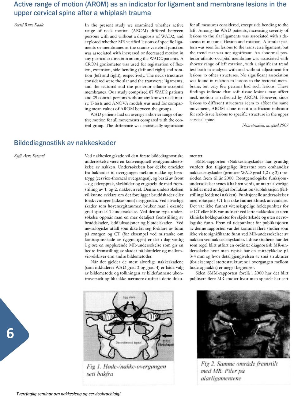 was associated with increased or decreased motion in any particular direction among the WAD2 patients.