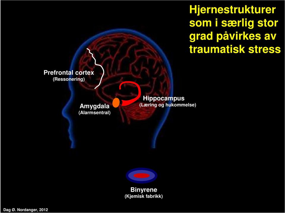 Amygdala (Alarmsentral) Hippocampus (Læring og