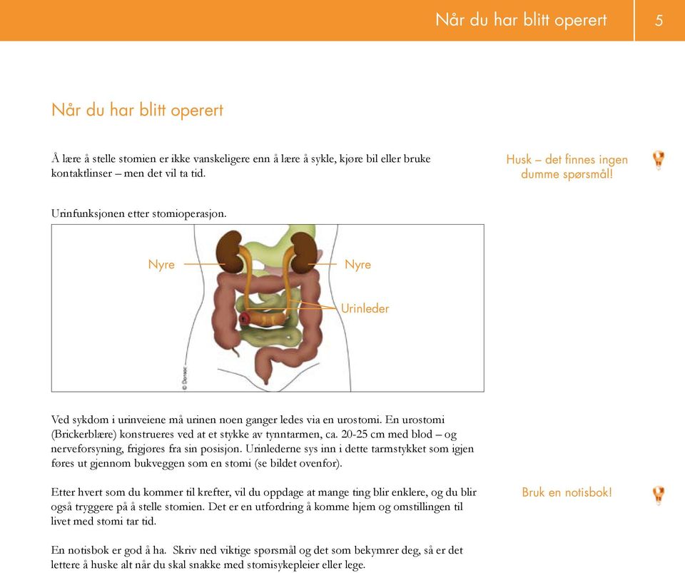 En urostomi (Brickerblære) konstrueres ved at et stykke av tynntarmen, ca. 20-25 cm med blod og nerveforsyning, frigjøres fra sin posisjon.