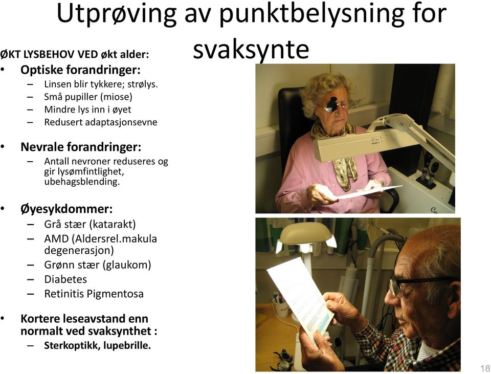 gir lysømfintlighet, ubehagsblending. Øyesykdommer: Grå stær (katarakt) AMD (Aldersrel.