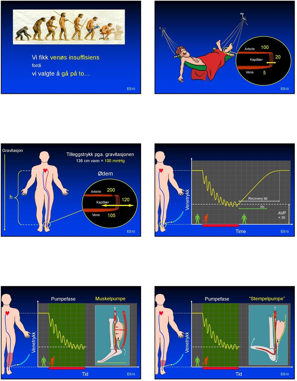 gravitasjonen 136 cm vann = 100 mmhg Ødem h Arterie Vene Kapillær 200 105