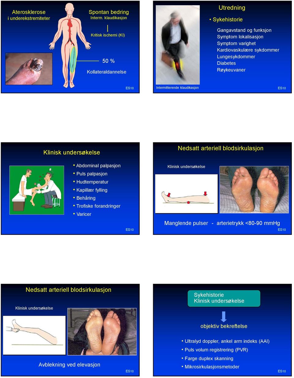 Røykeuvaner Intermitterende klaudikasjon Klinisk undersøkelse Nedsatt arteriell blodsirkulasjon Abdominal palpasjon Puls palpasjon Hudtemperatur Kapillær fylling Behåring Trofiske forandringer