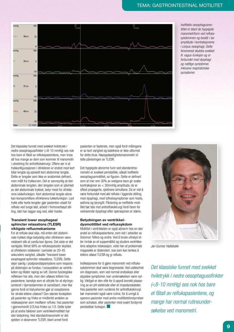 Det klassiske funnet med svekket hviletrykk i nedre oesophagussfinkter (<8-10 mmhg) ses nok hos bare et fåtall av reflukspasientene, men tross alt hos mange av dem som kommer til manometri i