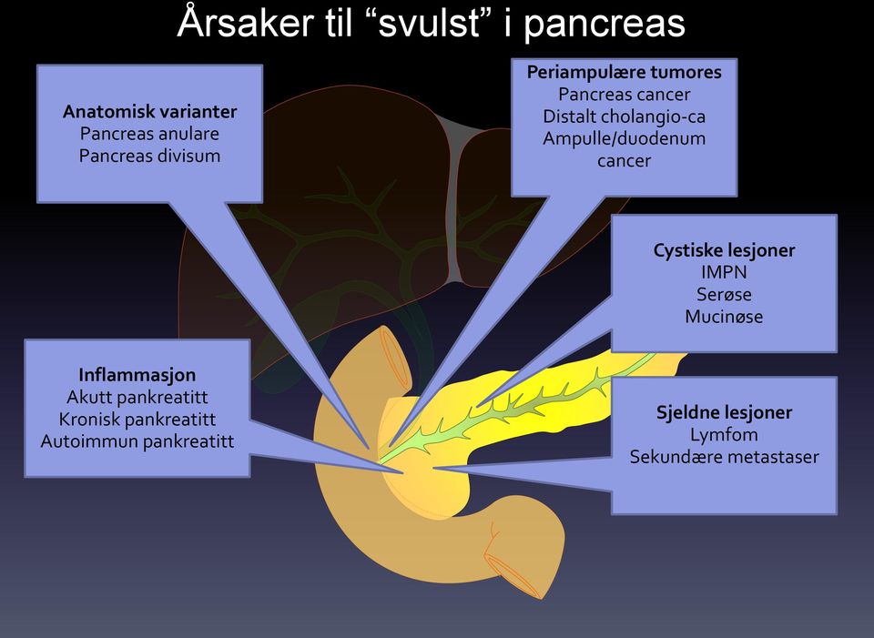 Ampulle/duodenum cancer Cystiske lesjoner IMPN Serøse Mucinøse Inflammasjon