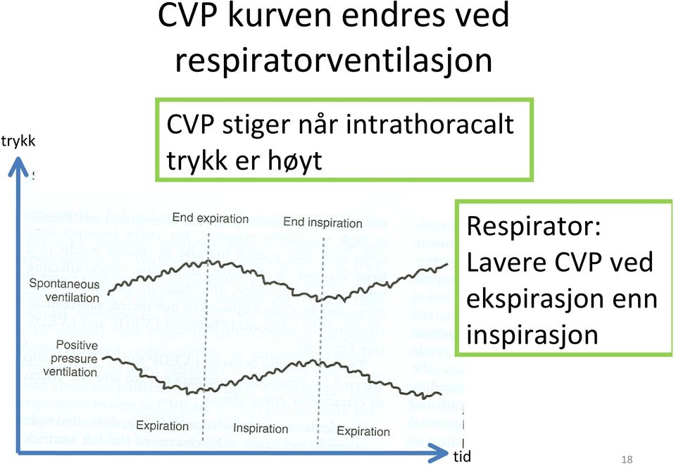 når intrathoracalt trykk er høyt