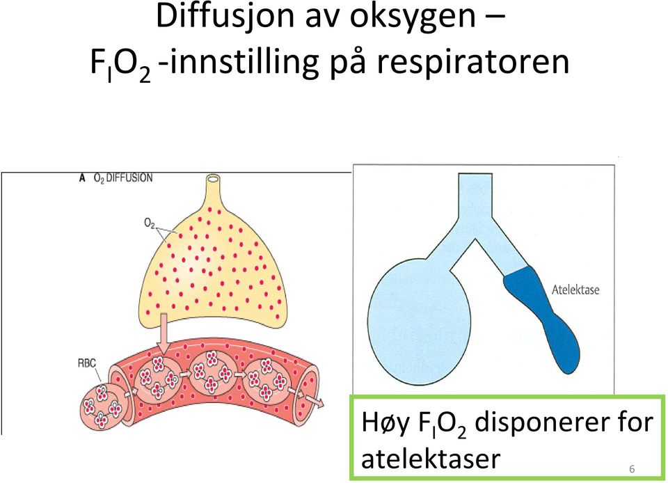 respiratoren Høy F I O 2