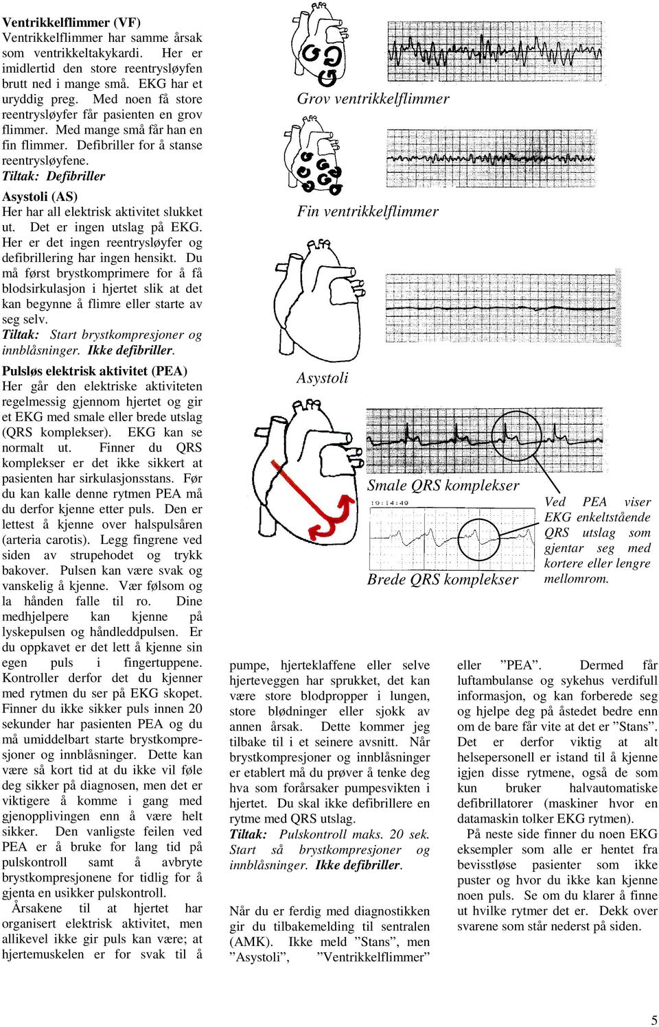 Tiltak: Defibriller Asystoli (AS) Her har all elektrisk aktivitet slukket ut. Det er ingen utslag på EKG. Her er det ingen reentrysløyfer og defibrillering har ingen hensikt.