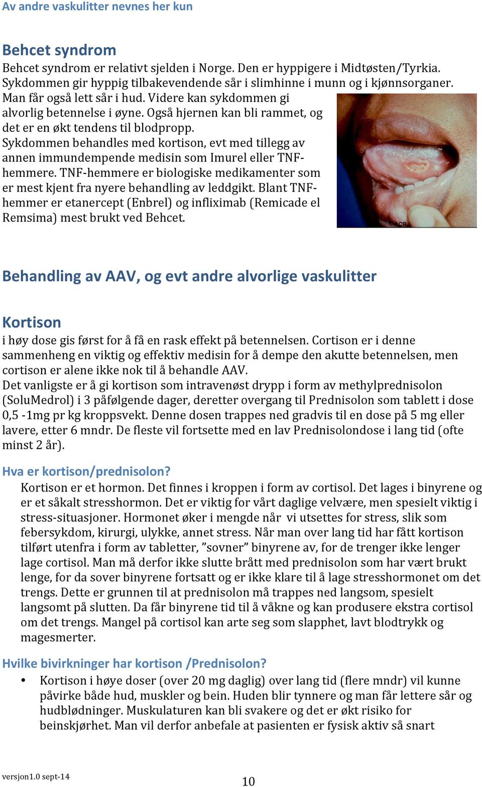 Også hjernen kan bli rammet, og det er en økt tendens til blodpropp. Sykdommen behandles med kortison, evt med tillegg av annen immundempende medisin som Imurel eller TNF- hemmere.