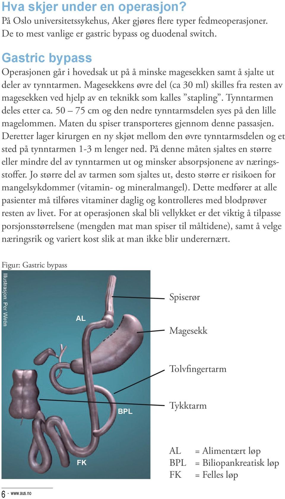 Magesekkens øvre del (ca 30 ml) skilles fra resten av magesekken ved hjelp av en teknikk som kalles stapling. Tynntarmen deles etter ca.