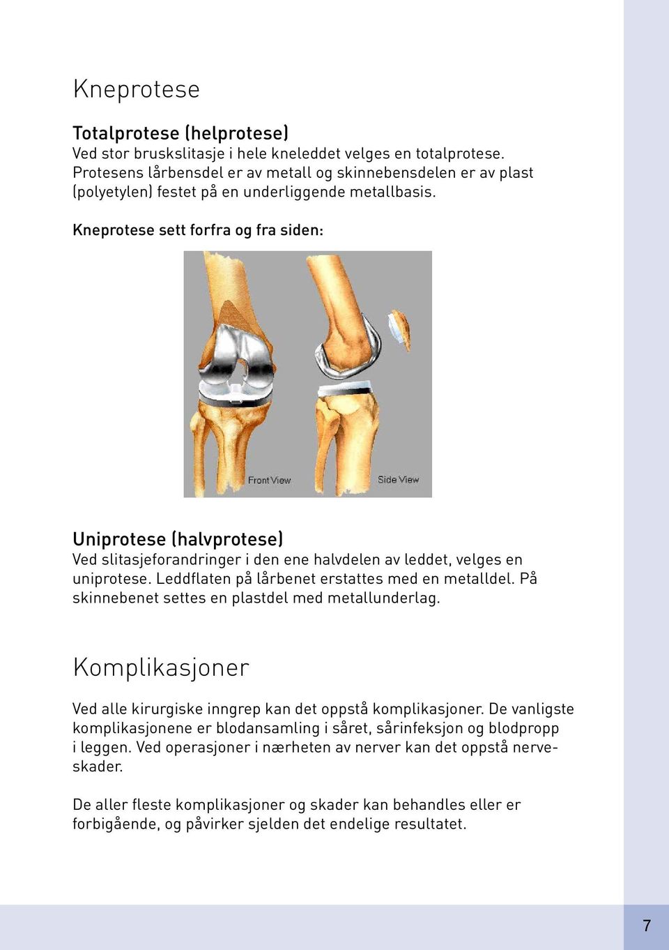 Kneprotese sett forfra og fra siden: Uniprotese (halvprotese) Ved slitasjeforandringer i den ene halvdelen av leddet, velges en uniprotese. Leddflaten på lårbenet erstattes med en metalldel.