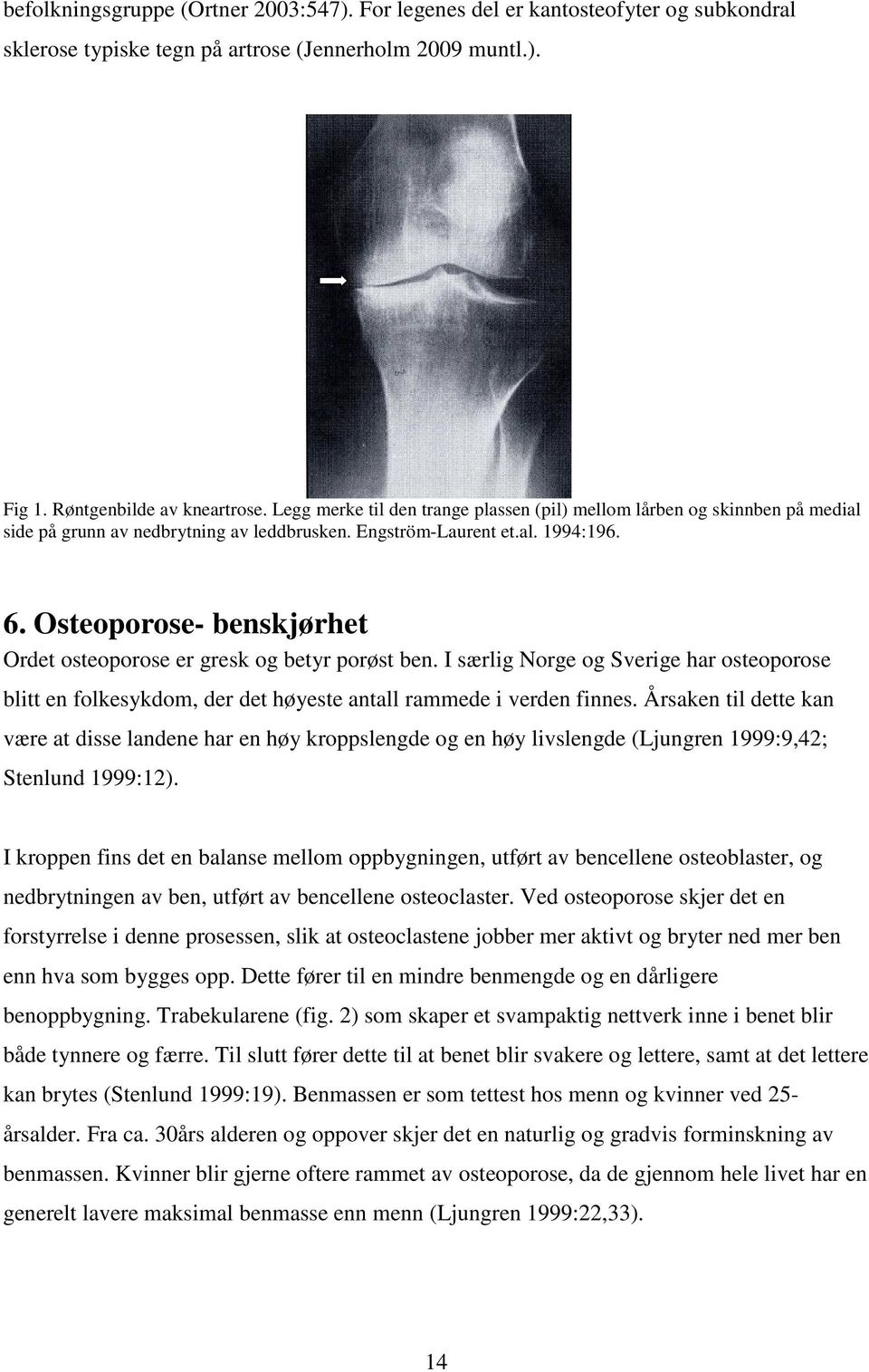 Osteoporose- benskjørhet Ordet osteoporose er gresk og betyr porøst ben. I særlig Norge og Sverige har osteoporose blitt en folkesykdom, der det høyeste antall rammede i verden finnes.