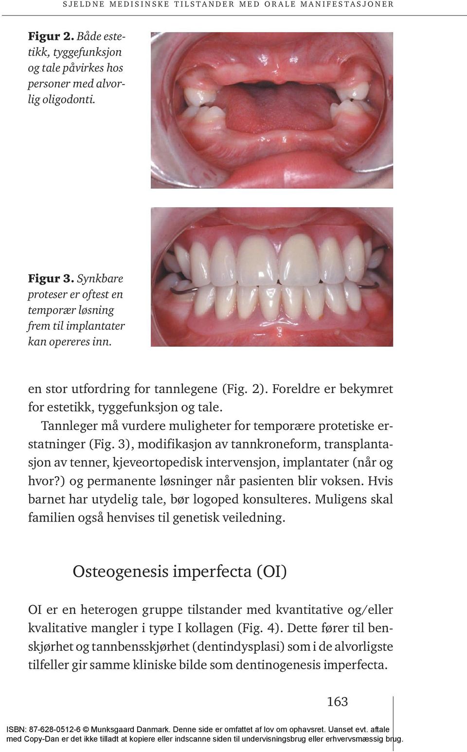 3), modifikasjon av tannkroneform, transplantasjon av tenner, kjeveortopedisk intervensjon, implantater (når og hvor?) og permanente løsninger når pasienten blir voksen.