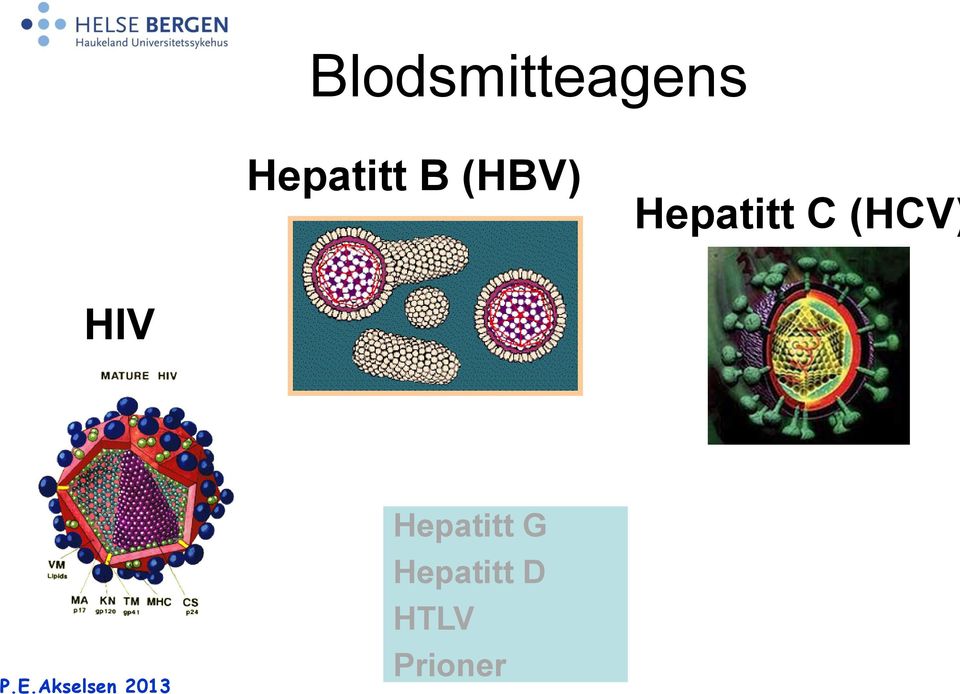 Hepatitt C (HCV) HIV