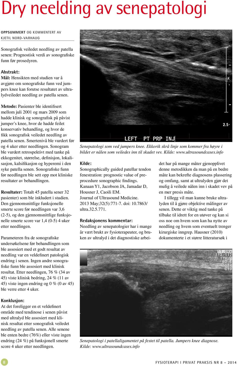 Metode: Pasienter ble identifisert mellom juli 2001 og mars 2009 som hadde klinisk og sonografisk på påvist jumper s knee, hvor de hadde feilet konservativ behandling, og hvor de fikk sonografisk