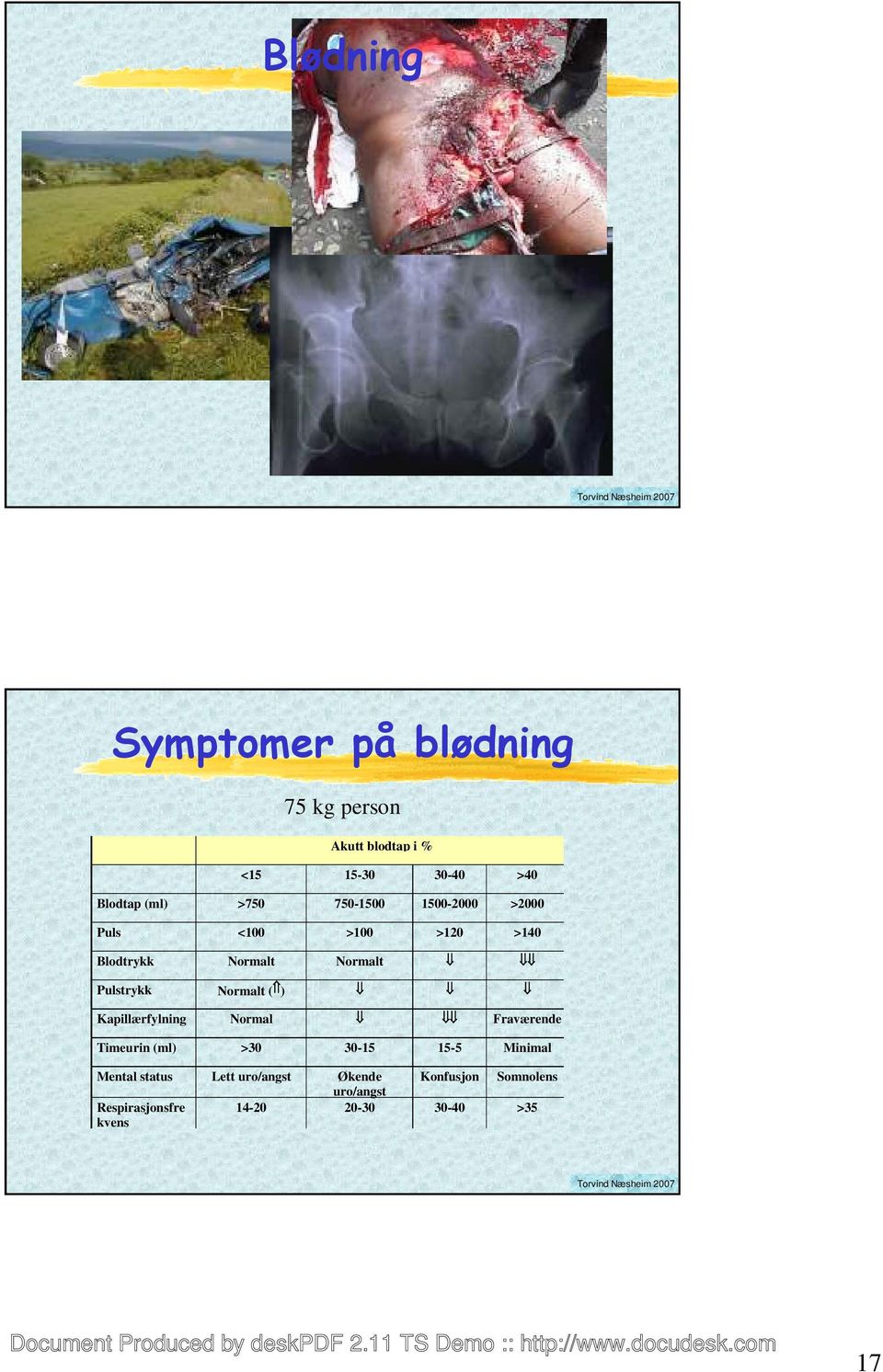 Normalt ( ) Kapillærfylning Normal Fraværende Timeurin (ml) >30 30-15 15-5 Minimal Mental