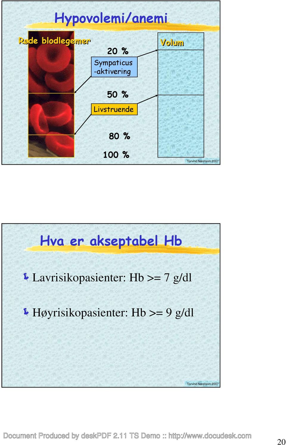 80 % 100 % Hva er akseptabel Hb