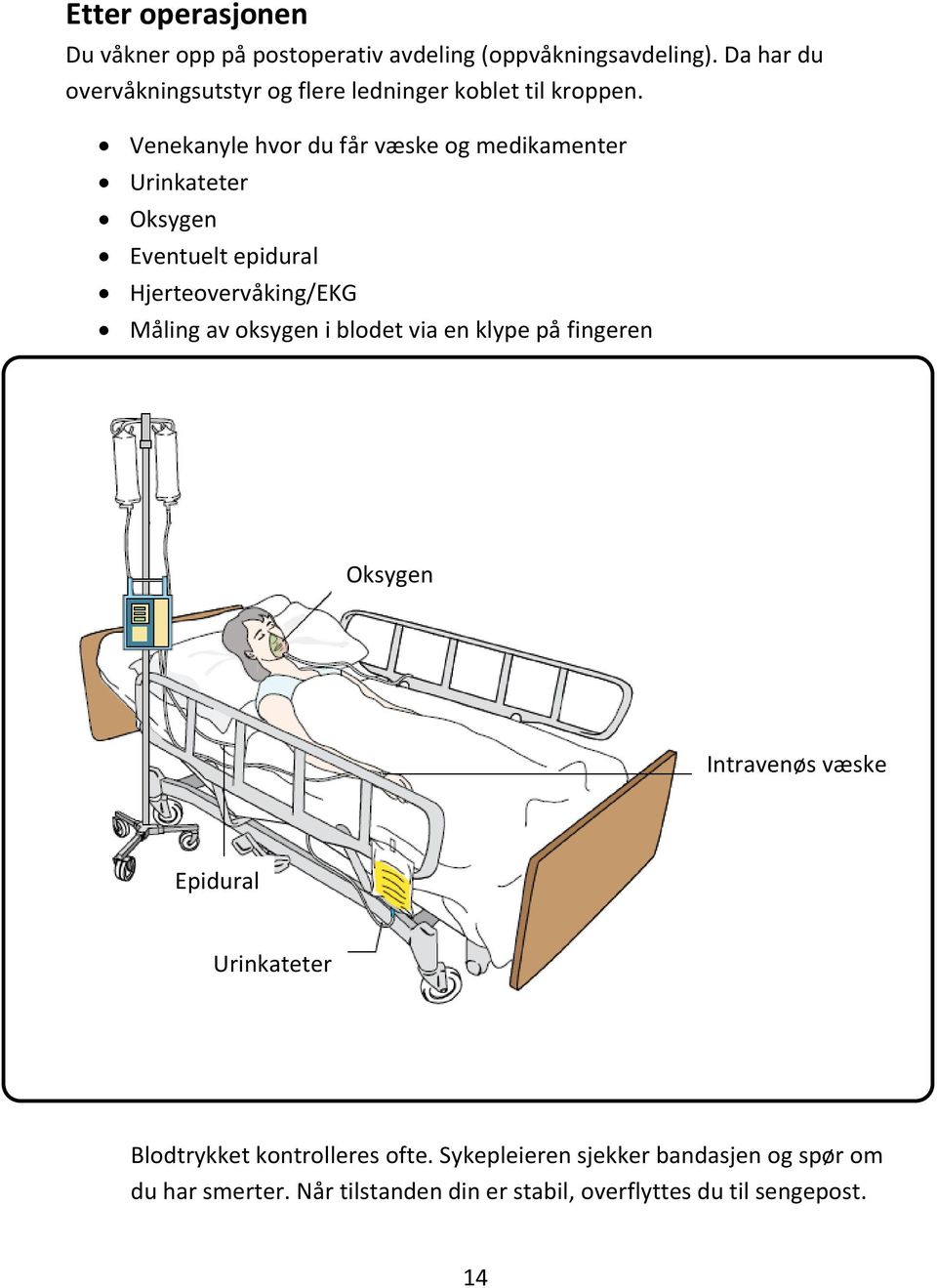 Venekanyle hvor du får væske og medikamenter Urinkateter Oksygen Eventuelt epidural Hjerteovervåking/EKG Måling av oksygen i