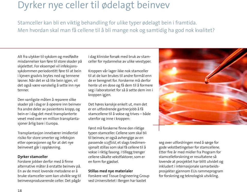 For eksempel vil infeksjonssykdommen periodontitt føre til at bein i kjeven gradvis brytes ned og tennene løsner. Når det er så lite bein igjen, vil det også være vanskelig å sette inn nye tenner.