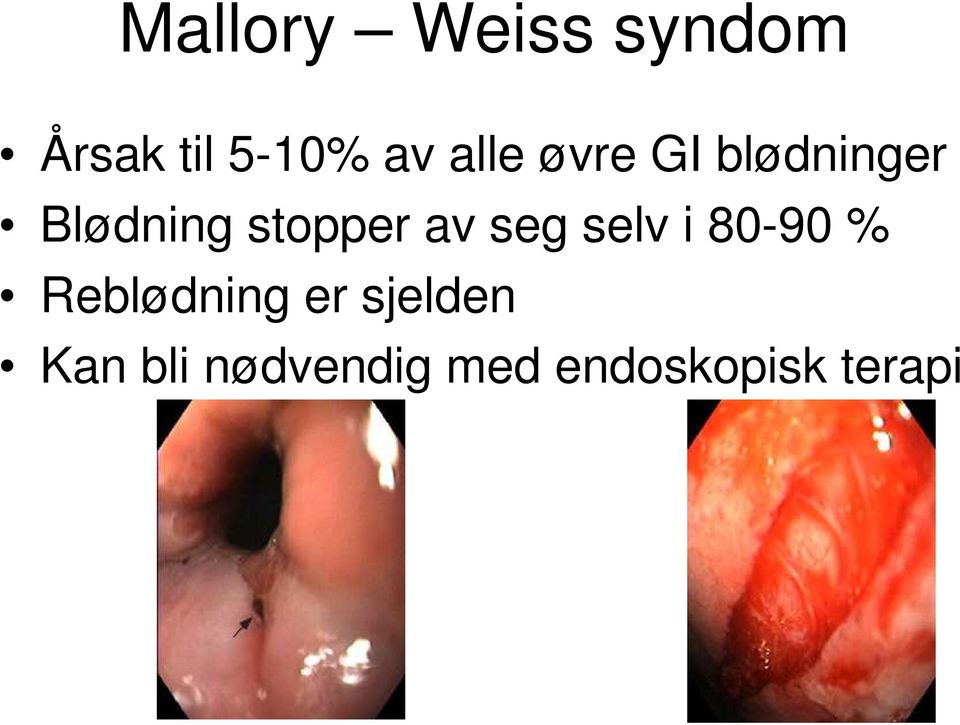 av seg selv i 80-90 % Reblødning er