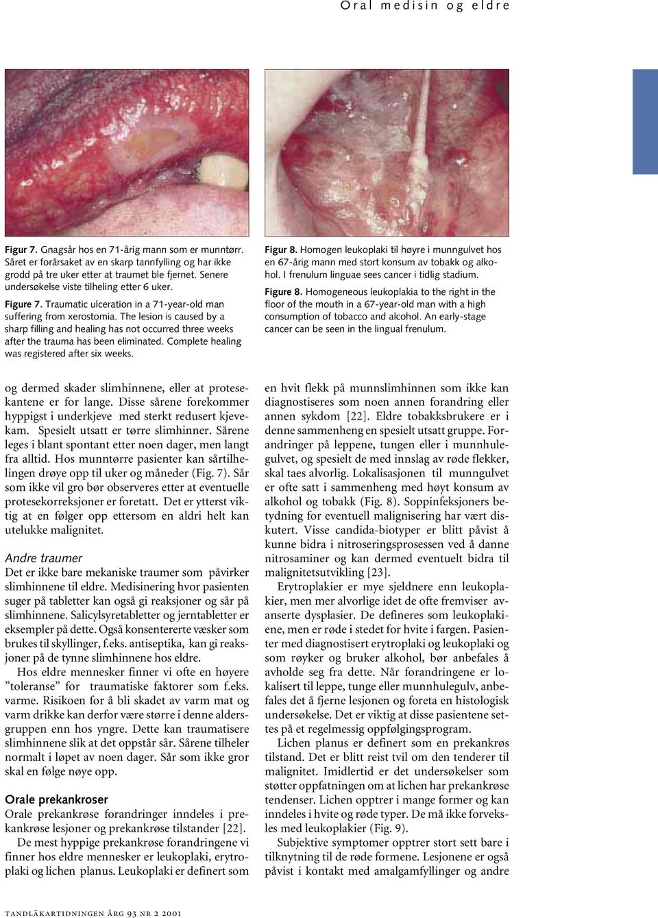 The lesion is caused by a sharp filling and healing has not occurred three weeks after the trauma has been eliminated. Complete healing was registered after six weeks. Figur 8.