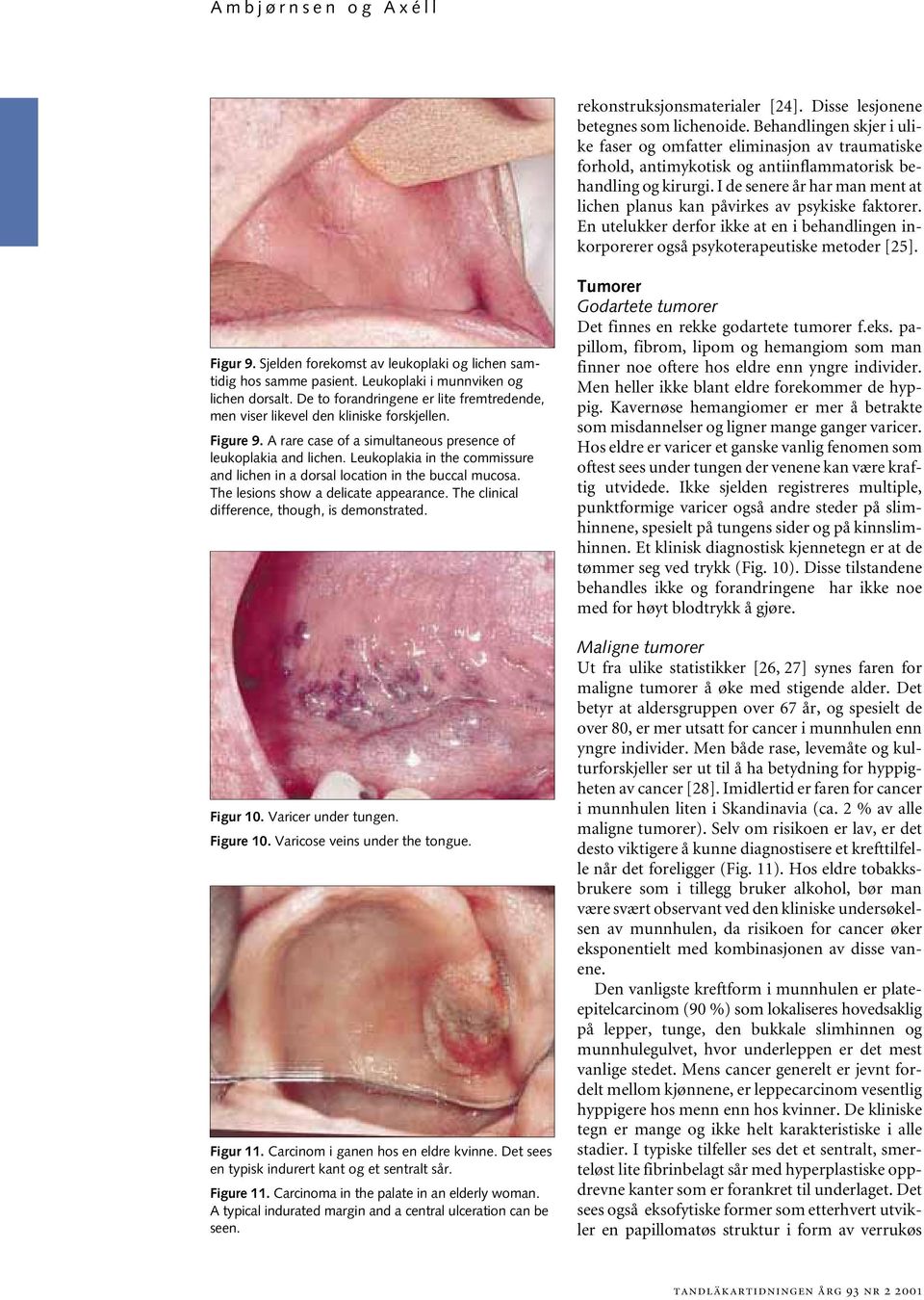 I de senere år har man ment at lichen planus kan påvirkes av psykiske faktorer. En utelukker derfor ikke at en i behandlingen inkorporerer også psykoterapeutiske metoder [25]. Figur 9.